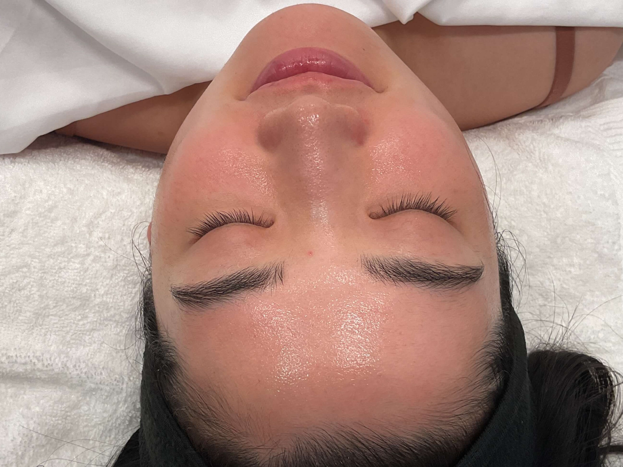 Before and After Photos After