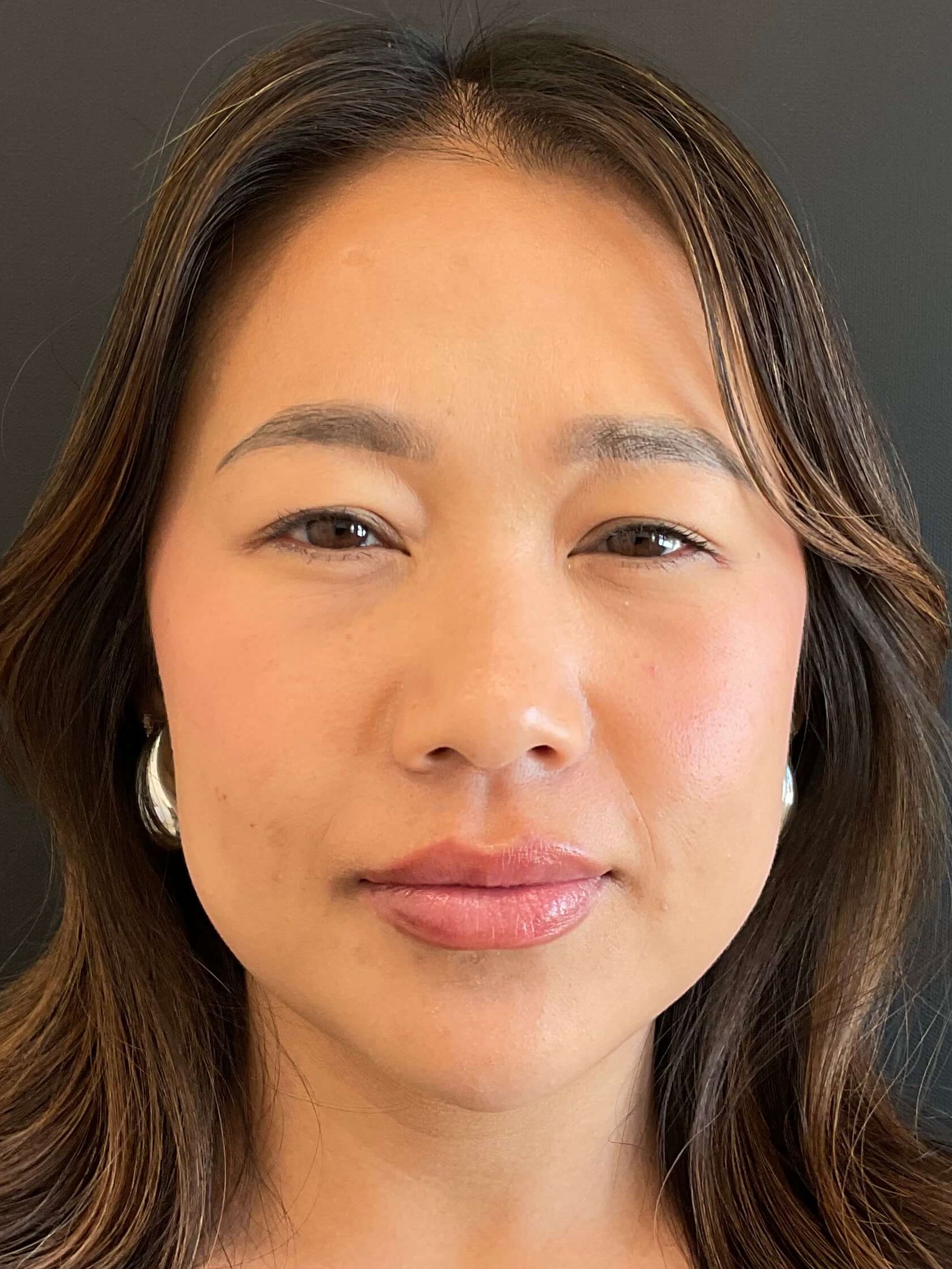 Before and After Photos After