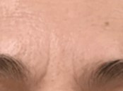 Eleven Line Correction Before