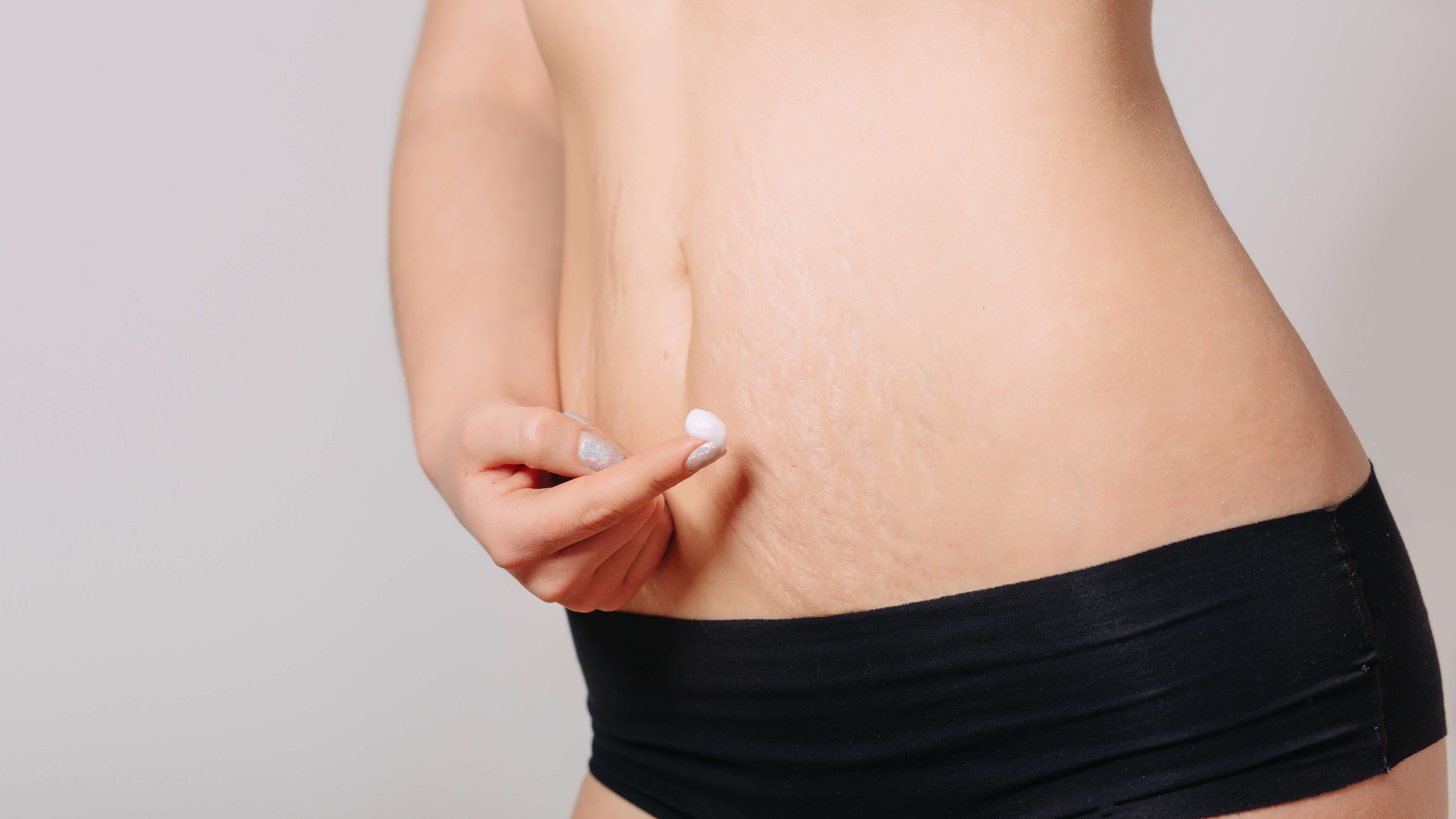 Does Nonsurgical Skin Tightening Work on Loose Skin Around the Waist?